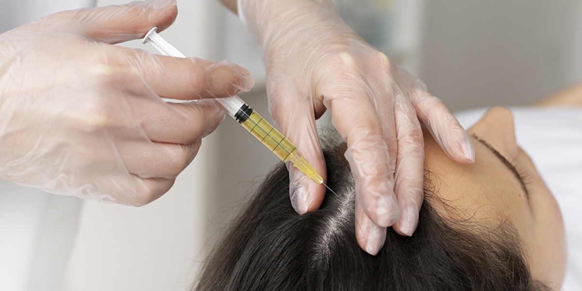 PRP For Hair Growth