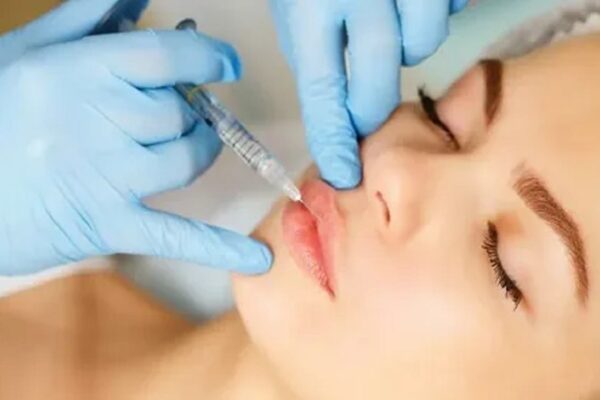 Lip Fillers Injections in Riyadh